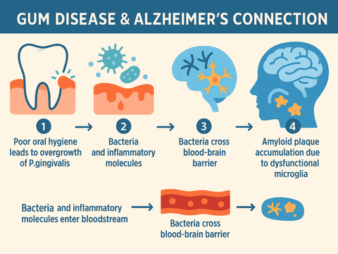 An infographic giving a very high level explanation of gum disease and it's connection to Alzheimer's.
