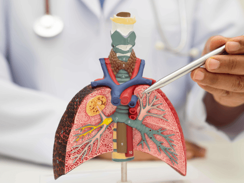 A doctor points to a medical model of the lungs, explaining how multiple sclerosis difficulty swallowing can lead to aspiration pneumonia.