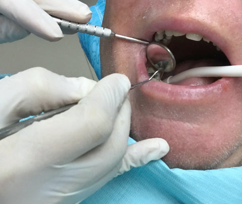 "Patient sitting in a dental chair while a dentist examines a cavity with dental tools under bright clinic lighting