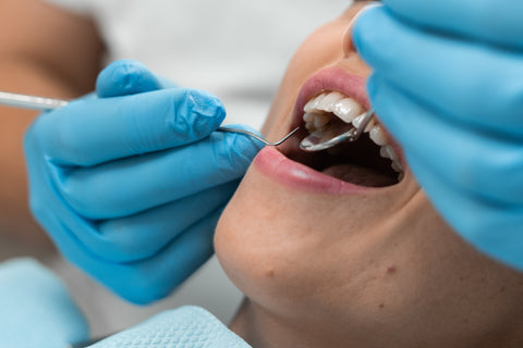 How to Avoid Cavities: A Complete Prevention Guide