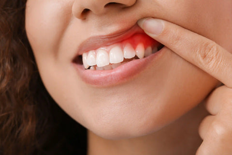 A woman is using her fingers to open her mouth and show her teeth and gums.