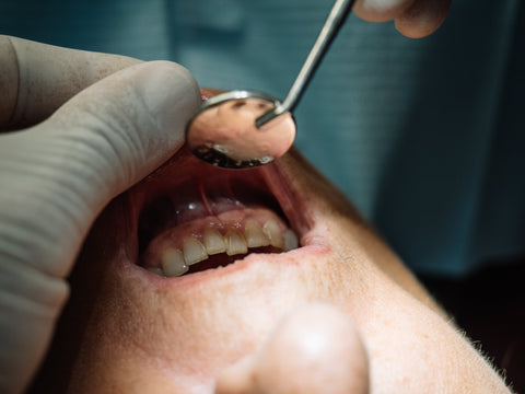 A dental patient having their teeth and gums examined with a small mirror tool by a professional dentist in a clean, bright clinic.